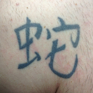 minimalist tattoos hong kong Hong Kong Laser Tattoo Removal Clinic
